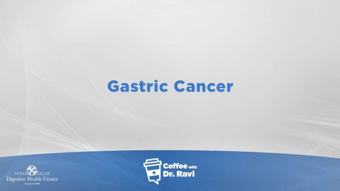Coffee with Dr. Ravi #77: Gastric Cancer