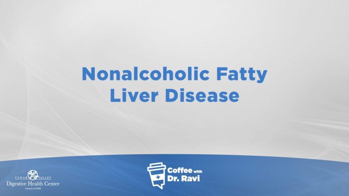 Coffee with Dr. Ravi #80: Nonalcoholic Fatty Liver Disease